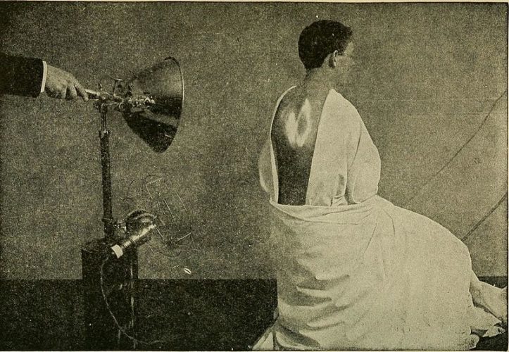 Image depicts an electric arc incandescent light being used therapeutically in 1918. Source: Reclaiming the Maimed: A Handbook of Physical Therapy - Red Light Therapy