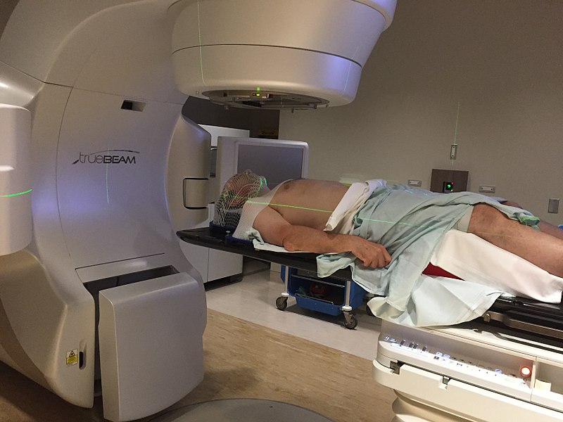 Radiotherapy machine treating patient with oropharyngeal cancer.