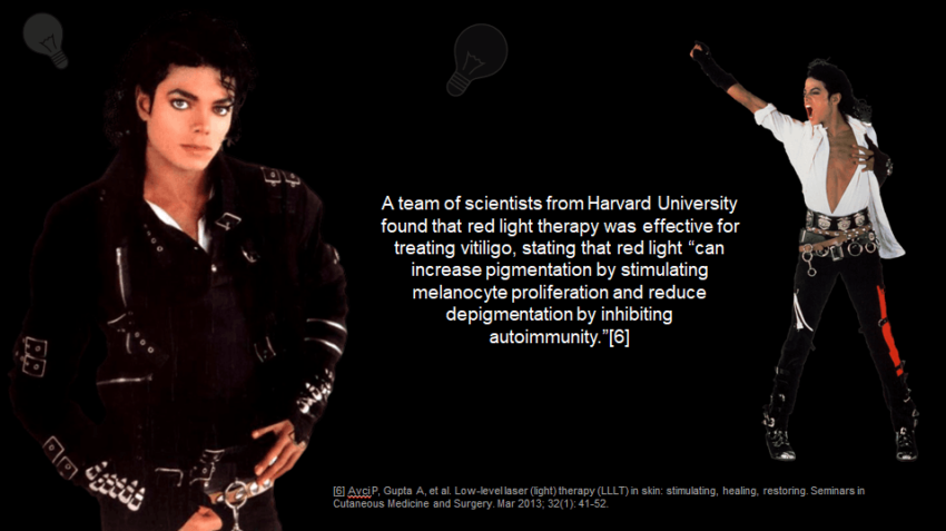 Michael Jackson Vitiligo - can be treated using red light